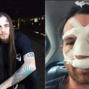 VULVODYNIA “απομάκρυναν τον τραγουδιστή Duncan Bentley λόγω σοβαρού περιστατικού βίας στο Drummer”